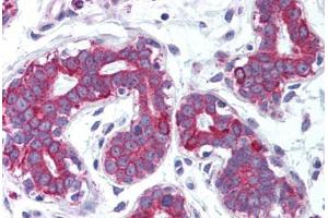 Human Breast (formalin-fixed, paraffin-embedded) stained with TNFSF11 antibody ABIN214007 at 5 ug/ml followed by biotinylated goat anti-rabbit IgG secondary antibody ABIN481713, alkaline phosphatase-streptavidin and chromogen. (RANKL Antikörper  (Internal Region))