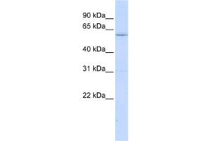 WB Suggested Anti-LRRC15 Antibody Titration:  0. (LRRC15 Antikörper  (N-Term))
