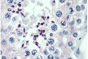 Human Testis: Formalin-Fixed, Paraffin-Embedded (FFPE) (PRDM9 Antikörper  (AA 431-480))