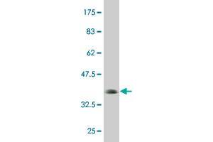Western Blot detection against Immunogen (36. (UHRF1 Antikörper  (AA 694-793))