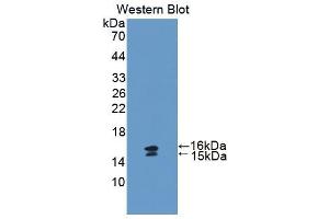 Western blot analysis of the recombinant protein. (Vip Antikörper  (AA 34-157))