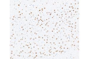 Immunohistochemistry (IHC) image for anti-Myocyte Enhancer Factor 2C (MEF2C) (AA 425-475) antibody (ABIN7795747) (Rekombinanter MEF2C Antikörper  (AA 425-475))