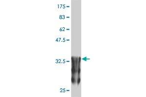 Western Blot detection against Immunogen (37. (ANKRD17 Antikörper  (AA 2501-2603))