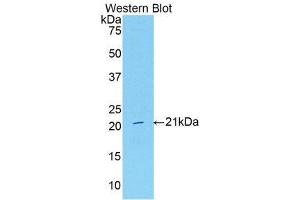 Western Blotting (WB) image for anti-Serpin Peptidase Inhibitor, Clade G (C1 Inhibitor), Member 1 (SERPING1) (AA 35-179) antibody (ABIN3208986) (SERPING1 Antikörper  (AA 35-179))