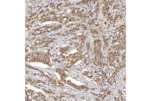 IHC analysis of U1A/SNRPA using anti-U1A/SNRPA antibody (ABIN7600891). (SNRPA1 Antikörper  (AA 25-218))