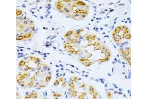Immunohistochemistry of paraffin-embedded Human stomach using CYP2E1 Polyclonal Antibody at dilution of 1:100 (40x lens). (CYP2E1 Antikörper)