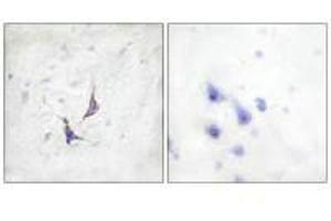 Immunohistochemistry analysis of paraffin-embedded human brain tissue using Syndecan4 (Ab-179) antibody. (SDC4 Antikörper  (Ser179))
