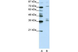WB Suggested Anti-AKAP9 Antibody Titration:  1. (AKAP9 Antikörper  (N-Term))
