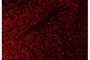 IF analysis of SAP18 using anti-SAP18 antibody (ABIN7599009).