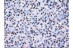 Image no. 11 for anti-Replication Protein A2, 32kDa (RPA2) antibody (ABIN1500736)