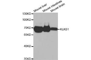 Western Blotting (WB) image for anti-Kallikrein B, Plasma (Fletcher Factor) 1 (KLKB1) antibody (ABIN1876506) (KLKB1 Antikörper)