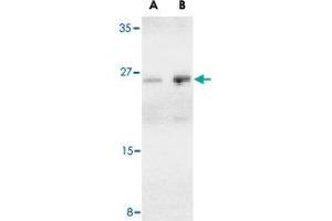 Western blot analysis of BCAP29 in human heart tissue lysate with BCAP29 polyclonal antibody  at (A) 1 and (B) 2 ug/mL .
