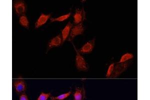 Immunofluorescence analysis of NIH/3T3 cells using GPER1 Polyclonal Antibody at dilution of 1:100. (Mesothelin Antikörper)