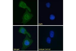 Immunofluorescence staining of fixed HeLa cells with anti-Cardiac Troponin I antibody scFv 180.