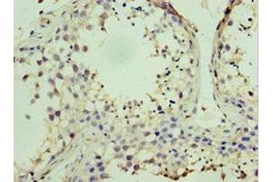 Immunohistochemistry of paraffin-embedded human testis tissue using ABIN7169001 at dilution of 1:100 (STK38 Antikörper  (AA 1-200))
