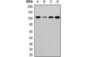 Western blot analysis of Sec5 expression in MCF7 (A), Hela (B), mouse lung (C), rat brain (D) whole cell lysates. (EXOC2 Antikörper)
