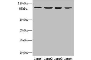 Western blot All lanes: ITGB7 antibody at 5. (Integrin beta 7 Antikörper  (AA 1-140))