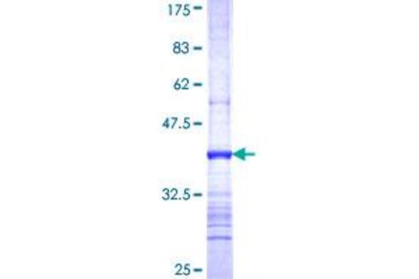 Metabotropic Glutamate Receptor 3 Protein (AA 21-120) (GST tag)