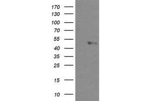Image no. 1 for anti-U-Box Domain Containing 5 (UBOX5) (AA 1-130), (AA 419-487) antibody (ABIN1490572) (UBOX5 Antikörper  (AA 1-130, AA 419-487))