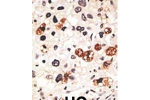 Immunohistochemistry (IHC) image for anti-Gap Junction Protein, beta 3, 31kDa (GJB3) (AA 227-257), (C-Term) antibody (ABIN5536021)