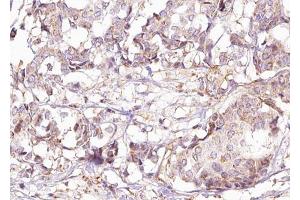 Immunohistochemistry (IHC) image for anti-SHC (Src Homology 2 Domain Containing) Transforming Protein 1 (SHC1) (pTyr427) antibody (ABIN6255915)