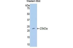 Western blot analysis of the recombinant protein. (IFNA10 Antikörper  (AA 24-189))