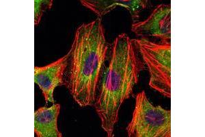 Immunofluorescence (IF) image for anti-Signal Transducer and Activator of Transcription 3 (Acute-Phase Response Factor) (STAT3) antibody (ABIN969421)