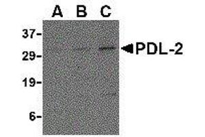 Western Blotting (WB) image for anti-Programmed Cell Death 1 Ligand 2 (PDCD1LG2) (Center) antibody (ABIN2479600) (PDCD1LG2 Antikörper  (Center))