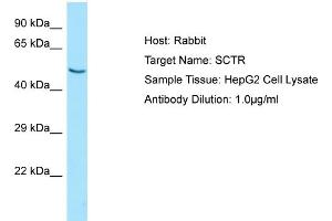 Western Blotting (WB) image for anti-Secretin Receptor (SCTR) (N-Term) antibody (ABIN2790165) (SCTR Antikörper  (N-Term))
