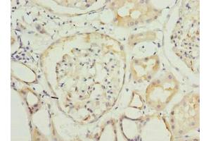 Immunohistochemistry of paraffin-embedded human kidney tissue using ABIN7166892 at dilution of 1:100 (PYCR2 Antikörper  (AA 2-320))