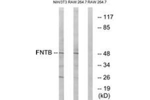 Western blot analysis of extracts from RAW264. (FNTB Antikörper  (AA 255-304))