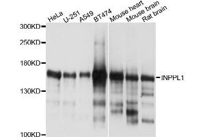Western blot analysis of extracts of various cells, using INPPL1 antibody. (INPPL1 Antikörper)