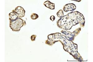 IHC analysis of CD16/Fcgr3 using anti-CD16/Fcgr3 antibody (ABIN7600325).
