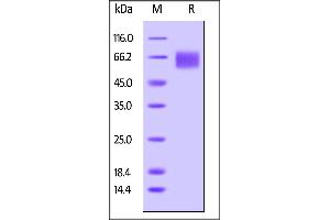 SDS-PAGE (SDS) image for Interleukin 6 Receptor, alpha (IL6RA) (AA 20-365) (Active) protein (His tag,AVI tag,Biotin) (ABIN5526621)