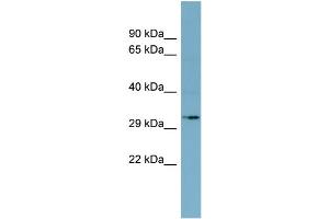 WB Suggested Anti-MGC4172 Antibody Titration:  0. (MGC4172 (Middle Region) Antikörper)