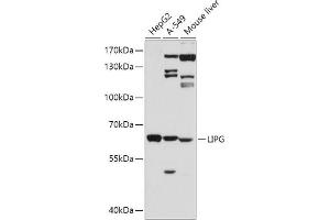 Western blot analysis of extracts of various cell lines, using LIPG antibody (ABIN3015671, ABIN3015672, ABIN3015673 and ABIN6219026) at 1:500 dilution. (LIPG Antikörper  (AA 251-500))