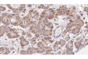 Immunohistochemistry (IHC) image for anti-Calcium Channel, Voltage-Dependent, T Type, alpha 1G Subunit (CACNA1G) (N-Term) antibody (ABIN6260396)