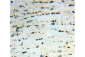 Used in DAB staining on fromalin fixed paraffin-embedded Heart tissue (CCL26 Antikörper  (AA 24-94))