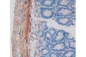 Used in DAB staining on fromalin fixed paraffin- embedded intestine tissue (WIF1 Antikörper  (AA 38-247))