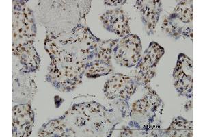 Immunoperoxidase of monoclonal antibody to TAF7 on formalin-fixed paraffin-embedded human placenta. (TAF7 Antikörper  (AA 130-224))