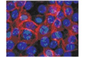 Human epidermal keratinocytes from neonatal foreskin stained in Immunofluorescence with TGM1 antibody Cat. (TGM1 Antikörper)