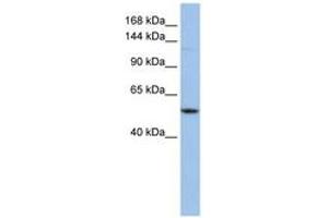 Image no. 1 for anti-Ubiquitination Factor E4A (UBE4A) (AA 720-769) antibody (ABIN6743147)