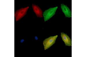 anti-Interphotoreceptor Matrix Proteoglycan 2 (IMPG2) antibody