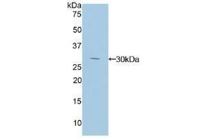 Detection of Recombinant IkBd, Human using Polyclonal Antibody to Inhibitory Subunit Of NF Kappa B Delta (IkBd) (IkBd Antikörper  (AA 46-285))