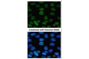 ICC/IF Image Immunofluorescence analysis of paraformaldehyde-fixed Human ESC, using SOX2, antibody at 1:100 dilution. (SOX2 Antikörper)