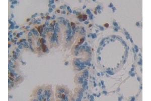 Immunohistochemistry (IHC) image for anti-serpin Peptidase Inhibitor, Clade B (Ovalbumin), Member 1 (SERPINB1) (AA 17-332) antibody (ABIN7443074)
