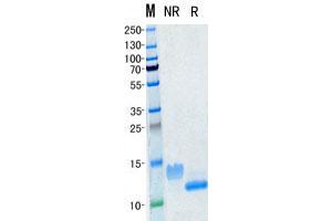 Validation with Western Blot (CXCL10 Protein)