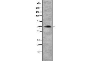 Western Blotting (WB) image for anti-Solute Carrier Family 29 (Nucleoside Transporters), Member 1 (SLC29A1) (N-Term) antibody (ABIN6261542)
