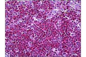 Human Spleen: Formalin-Fixed, Paraffin-Embedded (FFPE) (Neurofibromin 1 Antikörper  (Internal Region))