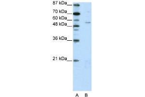 WB Suggested Anti-ZNF329 Antibody Titration:  2.